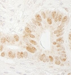 CTF18 Rabbit anti-Human, Polyclonal, Bethyl Laboratories 100 &mu;L; Unconjugated:Antibodies,