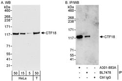 CTF18 Rabbit anti-Human, Polyclonal, Bethyl Laboratories 100 &mu;L; Unconjugated:Antibodies,