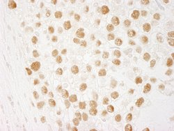 CTF18 Polyclonal Antibody, Bethyl Laboratories 10 &mu;l; Unlabeled:Antibodies,