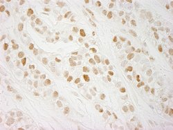 CTF18 Polyclonal Antibody, Bethyl Laboratories 10 &mu;l; Unlabeled:Antibodies,
