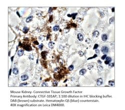 CTGF Rabbit anti-Human, Mouse, Rat, Polyclonal, FabGennix 200 &mu;L; Unconjugated:Antibodies,