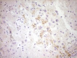 CTGF Mouse anti-Human, Clone: OTI6D1, TrueMAB , Origene 30 &mu;L | Buy Online | Origene Technologies | Fisher Scientific