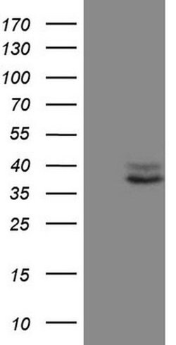 CTGF Monoclonal Antibody (OTI5C10), TrueMAB , OriGene:Antibodies:Primary