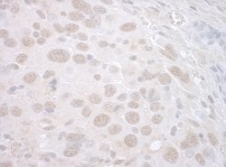 CTNNBL1 Polyclonal Antibody, Bethyl Laboratories:Antibodies:Primary Antibodies