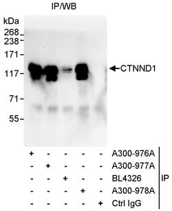 CTNND1 Rabbit anti-Human, Polyclonal, Bethyl Laboratories 100 &mu;L; Unconjugated:Antibodies,
