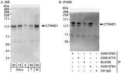 CTNND1 Rabbit anti-Human, Mouse, Polyclonal, Bethyl Laboratories 100 &mu;L;