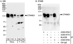 CTNND1 Rabbit anti-Human, Mouse, Polyclonal, Bethyl Laboratories 100 &mu;l;
