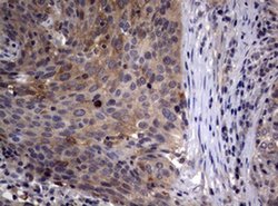 CTNND1 Monoclonal Antibody (OTI3G1), TrueMAB , OriGene:Antibodies:Primary