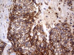 CTNND1 Monoclonal Antibody (OTI3G1), TrueMAB , OriGene 100 &mu;L; Unconjugated:Antibodies,
