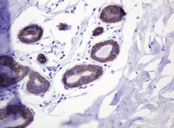 CTNND1 Monoclonal Antibody (OTI2E8), TrueMAB , OriGene 100 &mu;L | Buy Online | OriGene | Fisher Scientific