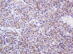 CTNND1 Monoclonal Antibody (OTI2E8), TrueMAB , OriGene 100 &mu;L | Buy Online | OriGene | Fisher Scientific