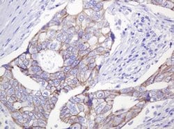 CTNND1 Monoclonal Antibody (OTI2E8), TrueMAB , OriGene 100 &mu;L | Buy Online | OriGene | Fisher Scientific