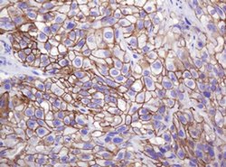 CTNND1 Monoclonal Antibody (OTI2E8), TrueMAB , OriGene 100 &mu;L | Buy Online | OriGene | Fisher Scientific