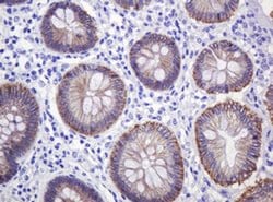 CTNND1 Monoclonal Antibody (OTI2E8), TrueMAB , OriGene 100 &mu;L | Buy Online | OriGene | Fisher Scientific