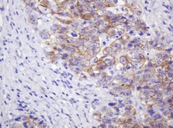 CTNND1 Monoclonal Antibody (OTI2E8), TrueMAB , OriGene 100 &mu;L | Buy Online | OriGene | Fisher Scientific