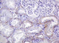 CTNND1 Monoclonal Antibody (OTI2E8), TrueMAB , OriGene 100 &mu;L | Buy Online | OriGene | Fisher Scientific