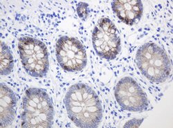 CTNND1 Mouse anti-Human, Clone: OTI2F8, lyophilized, TrueMAB 100 &mu;g;