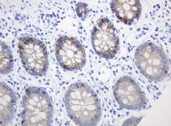 CTNND1 Monoclonal Antibody (OTI2F8), TrueMAB , OriGene 100 &mu;L; Unconjugated:Antibodies,