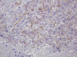 CTNND1 Monoclonal Antibody (OTI1G4), TrueMAB , OriGene 30 &mu;L; Unconjugated:Antibodies,