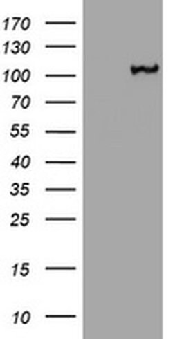 CTNND1 Monoclonal Antibody (OTI3G1), TrueMAB , OriGene 100 &mu;L; Unconjugated:Antibodies,