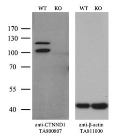 CTNND1 Monoclonal Antibody (OTI2E8), TrueMAB , OriGene 100 &mu;L | Buy Online | OriGene | Fisher Scientific