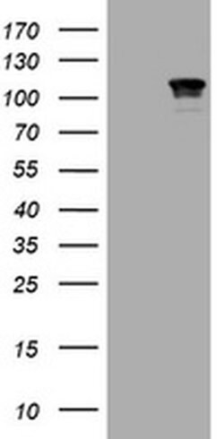 CTNND1 Monoclonal Antibody (OTI2F8), TrueMAB , OriGene 100 &mu;L; Unconjugated:Antibodies,