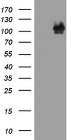 CTNND1 Monoclonal Antibody (OTI5F3), TrueMAB , OriGene 100 &mu;L; Unconjugated:Antibodies,