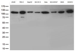 CTNND1 Monoclonal Antibody (OTI5F3), TrueMAB , OriGene 100 &mu;L; Unconjugated:Antibodies,