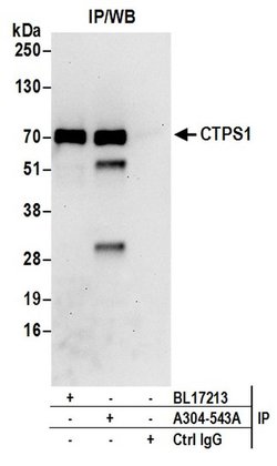 CTPS1 Rabbit anti-Human, Mouse, Polyclonal, Bethyl Laboratories 100 &mu;L;