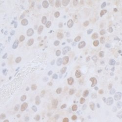 CTR9 Rabbit anti-Human, Mouse, Polyclonal, Bethyl Laboratories 100 &mu;l;