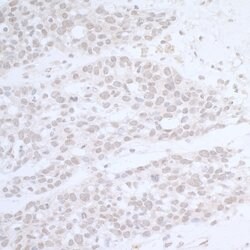 CTR9 Rabbit anti-Human, Mouse, Polyclonal, Bethyl Laboratories 100 &mu;l;