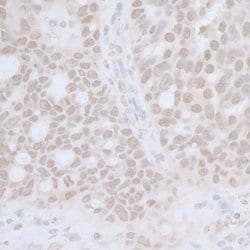 CTR9 Polyclonal Antibody, Bethyl Laboratories:Antibodies:Primary Antibodies