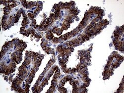 CTSL1 Monoclonal Antibody (OTI2H2), TrueMAB , OriGene 100 &mu;L; Unconjugated:Antibodies,