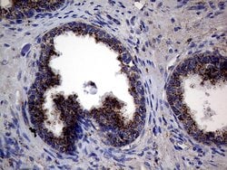 CTSL1 Monoclonal Antibody (OTI2H2), TrueMAB , OriGene 100 &mu;L; Unconjugated:Antibodies,