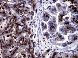 CTSL1 Monoclonal Antibody (OTI2H2), TrueMAB , OriGene 100 &mu;L; Unconjugated:Antibodies,
