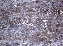 CTSL1 Monoclonal Antibody (OTI6B8), TrueMAB , OriGene 100 &mu;L; Unconjugated:Antibodies,