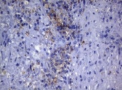 CTSL1 Monoclonal Antibody (OTI6B8), TrueMAB , OriGene 100 &mu;L; Unconjugated:Antibodies,