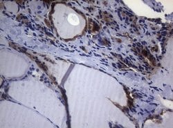 CTSL1 Mouse anti-Human, Clone: OTI8H2, lyophilized, TrueMAB 100 &mu;g;