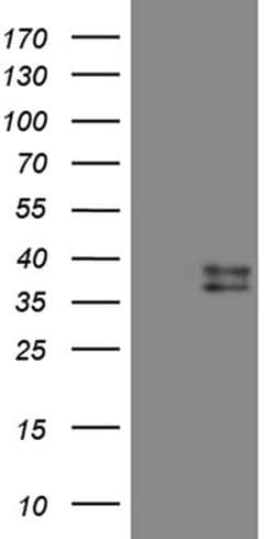 CTSL1 Monoclonal Antibody (OTI2H2), TrueMAB , OriGene 100 &mu;L; Unconjugated:Antibodies,