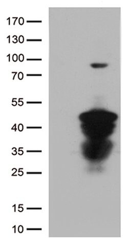 CTSL1 Mouse anti-Human, Clone: OTI5C8, lyophilized, TrueMAB 100 &mu;g;