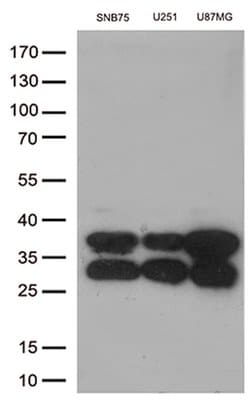 CTSL1 Mouse anti-Human, Clone: OTI5C8, lyophilized, TrueMAB 100 &mu;g;