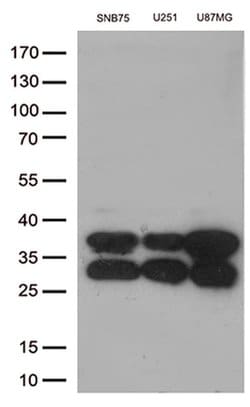 CTSL1 Monoclonal Antibody (OTI5C8), TrueMAB , OriGene 30 &mu;L; Unconjugated:Antibodies,