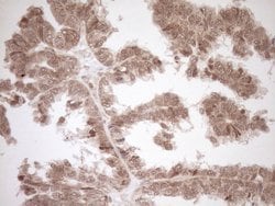 CWC27 Monoclonal Antibody (OTI2D1), TrueMAB , OriGene 100 &mu;L; Unconjugated:Antibodies,