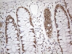 CWC27 Monoclonal Antibody (OTI4C8), TrueMAB , OriGene 100 &mu;L; Unconjugated:Antibodies,