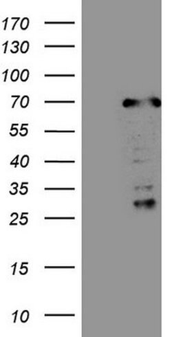 CWC27 Mouse anti-Human, Clone: OTI2D1, lyophilized, TrueMAB 100 &mu;g;