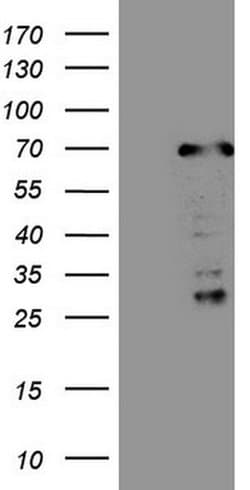 CWC27 Monoclonal Antibody (OTI2D1), TrueMAB , OriGene 100 &mu;L; Unconjugated:Antibodies,