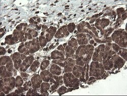 CXorf26 Monoclonal Antibody (OTI5A11), TrueMAB , OriGene 30 &mu;L; Unconjugated:Antibodies,