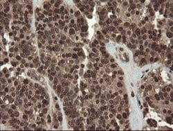 CXorf26 Monoclonal Antibody (OTI5A11), TrueMAB , OriGene 30 &mu;L; Unconjugated:Antibodies,