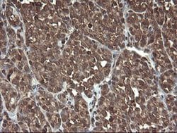 CXorf26 Monoclonal Antibody (OTI5A11), TrueMAB , OriGene 30 &mu;L; Unconjugated:Antibodies,