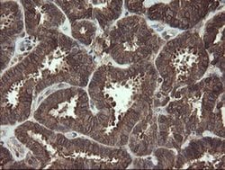 CXorf26 Monoclonal Antibody (OTI5A11), TrueMAB , OriGene 30 &mu;L; Unconjugated:Antibodies,